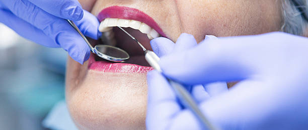 Best Emergency Root Canal Treatment in Prceton, IN